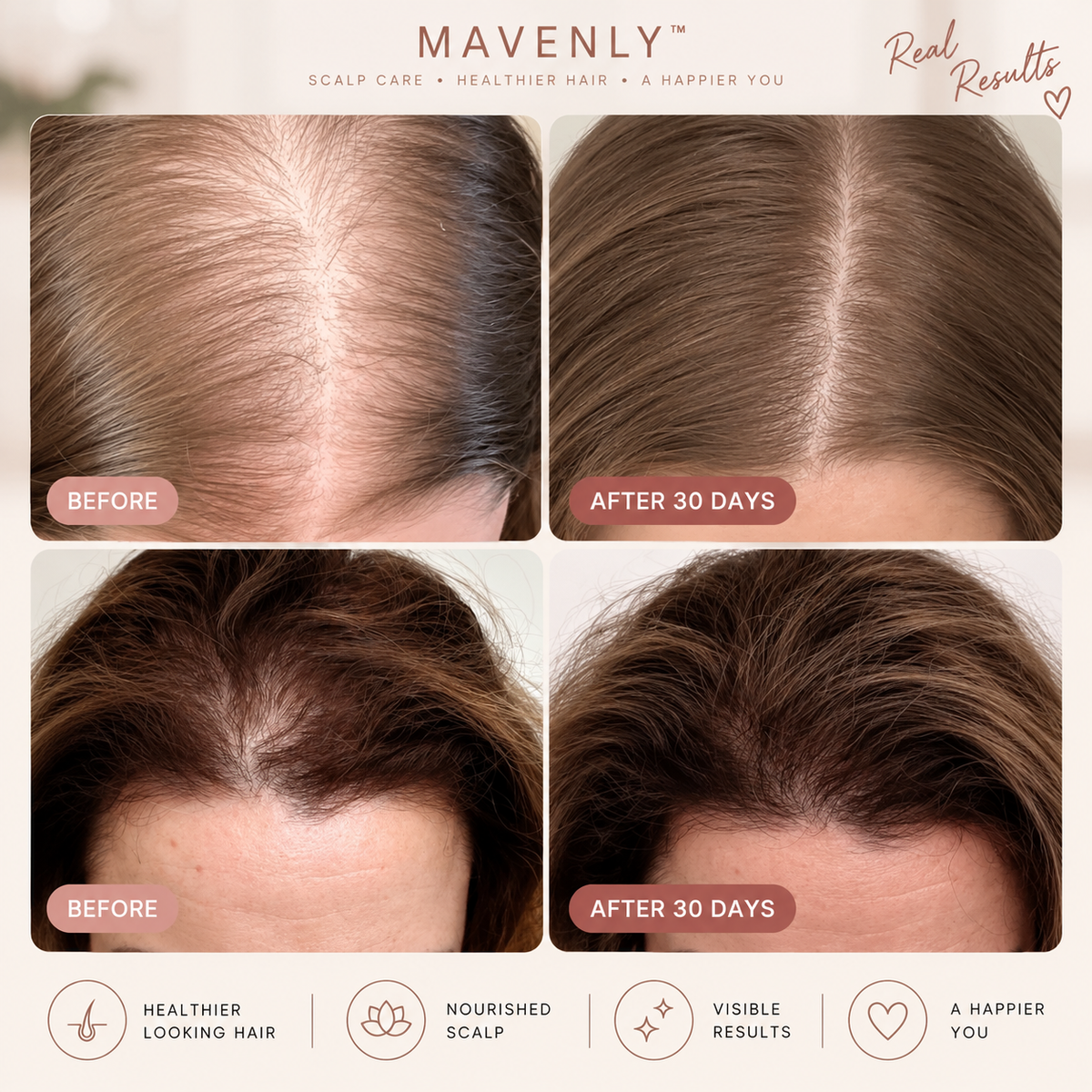 MAVENLY™ HeadSpa Scalp Massager